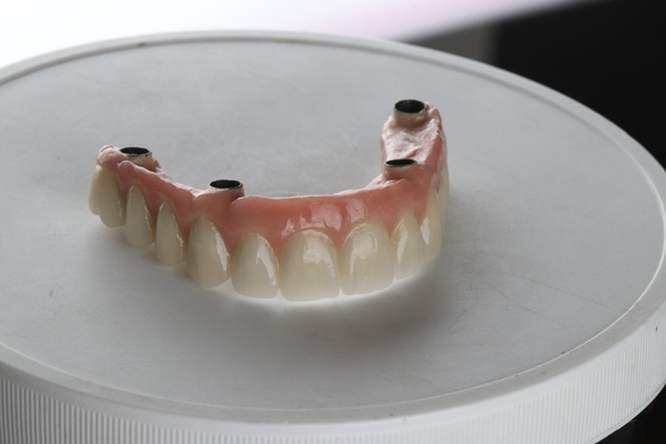 The Benefits Of Full Arch Treatment For Complete Tooth Replacement